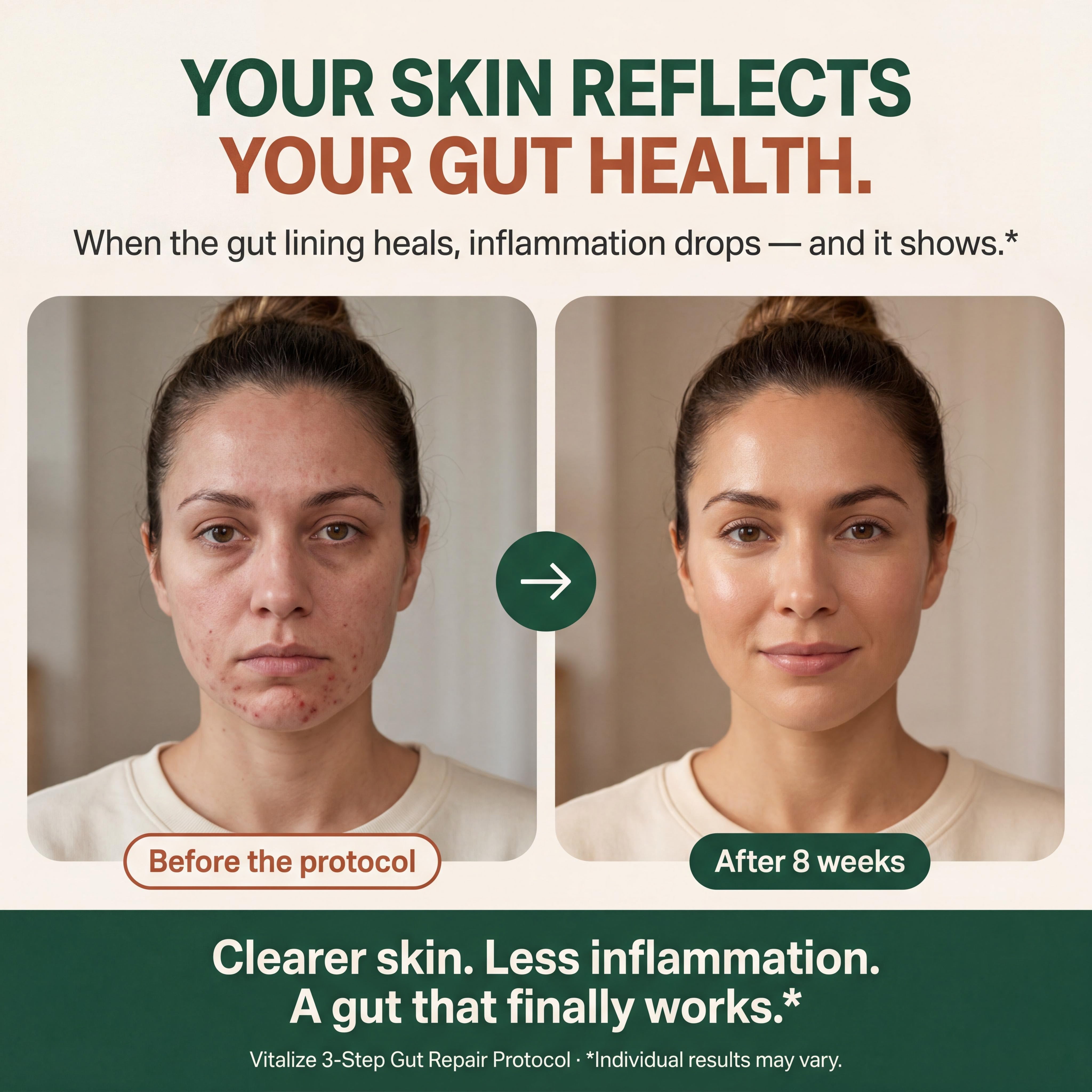 The 3-Step Gut Repair Protocol